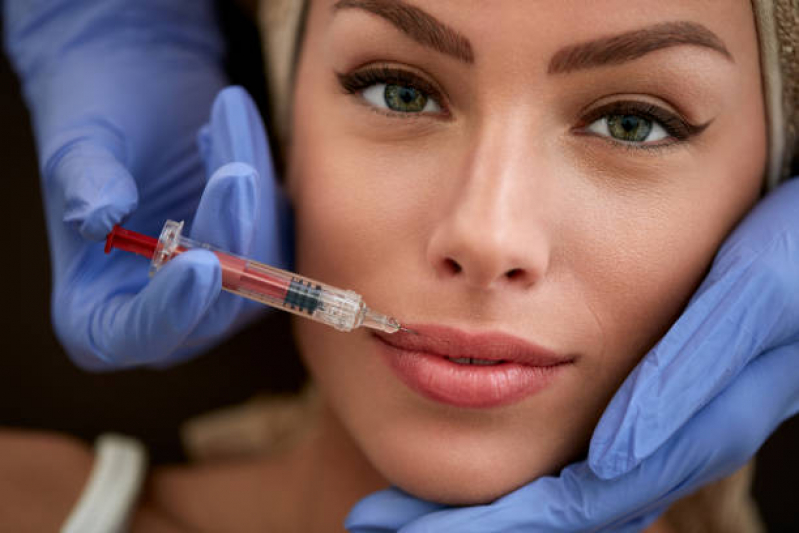 Botox para Remoção de Imperfeições Agendar Vila Maria - Botox Facial