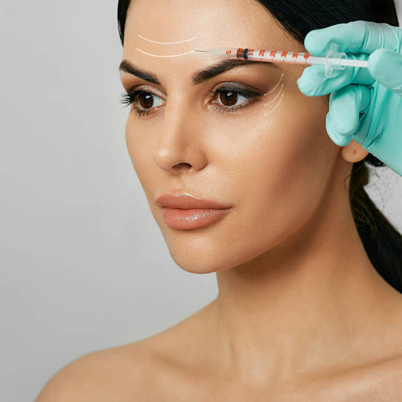 Botox para Remoção de Imperfeições Pompéia - Botox Facial