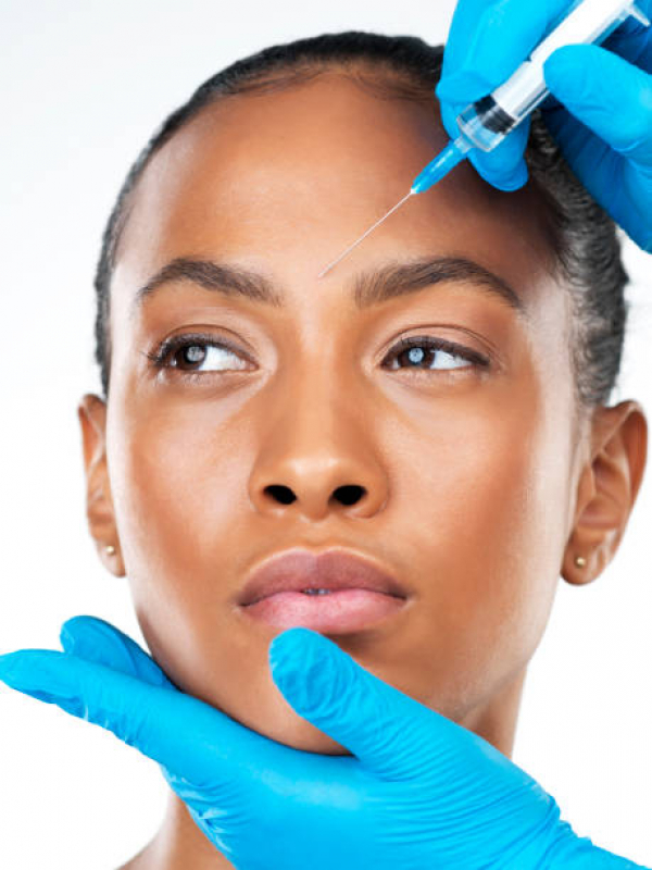 Onde Fazer Botox para Rejuvenescimento Vila Rabelo - Botox Facial