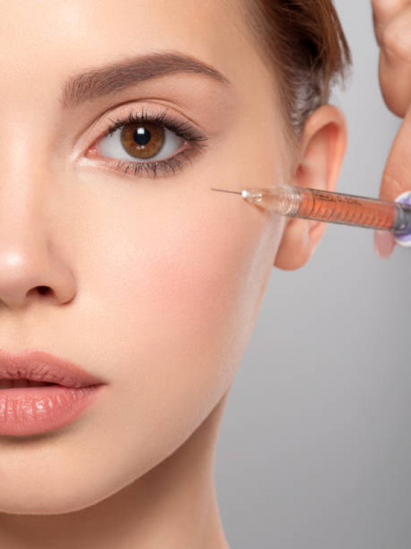 Onde Fazer Botox para Remoção de Imperfeições Freguesia do Ó - Botox Bruxismo