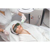 tratamento com ultraformer para afinar o rosto Serra da Cantareira